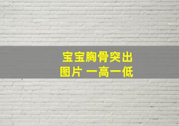 宝宝胸骨突出图片 一高一低